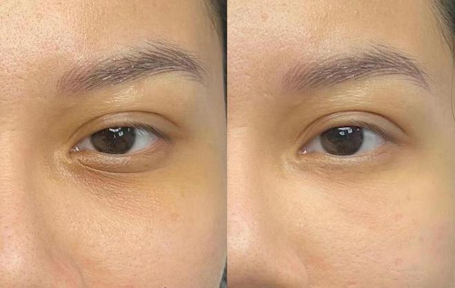 好？眼纹党必看买对不买贵的抗初老眼霜凯发k8登录vip什么眼霜去皱效果(图8)